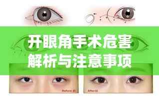 开眼角手术危害解析与注意事项指南——百度健康知识分享